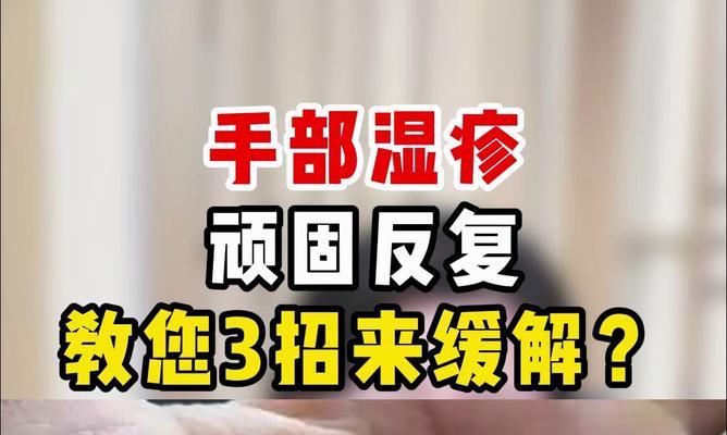 湿疹可以用哪些植物缓解？效果如何？